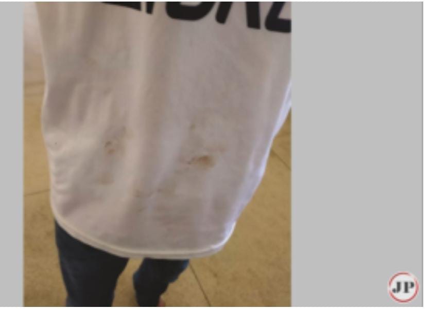 Jovem de 19 anos foi levado em estado grave para o hospital em Rubiataba após ser esfaqueado, o suspeito é um adolescente de 16 anos